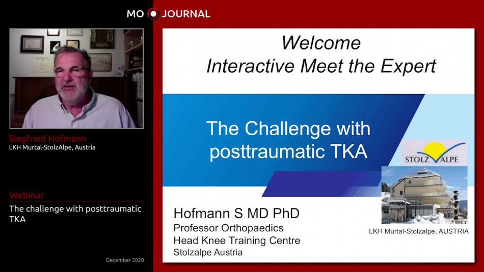 Meet the Expert : The challenge with posttraumatic TKA