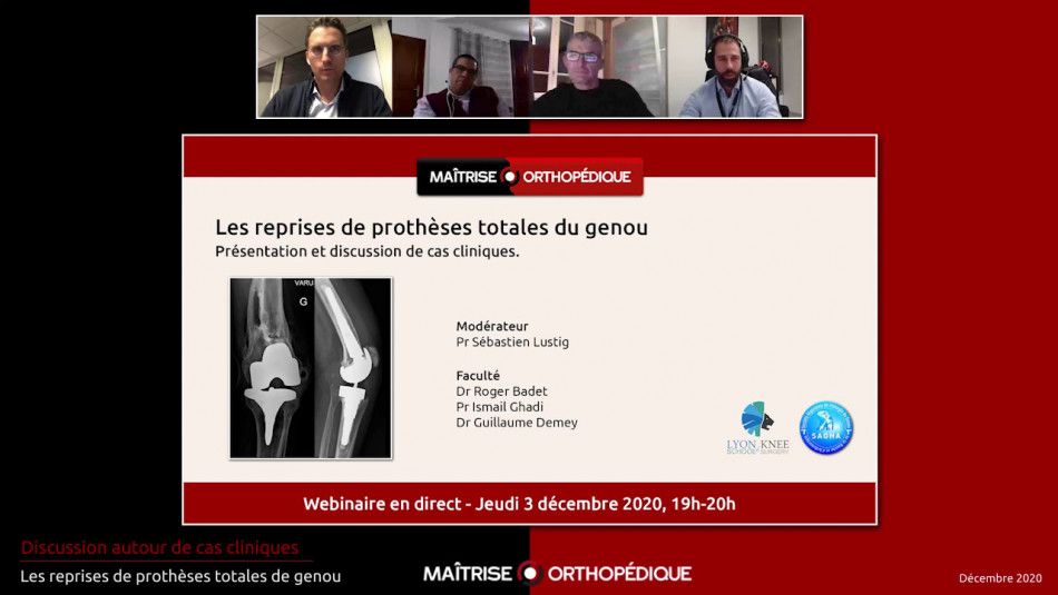 Les reprises de prothèses totales de genou