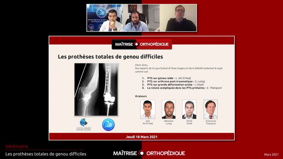 Les prothèses totales de genou difficiles