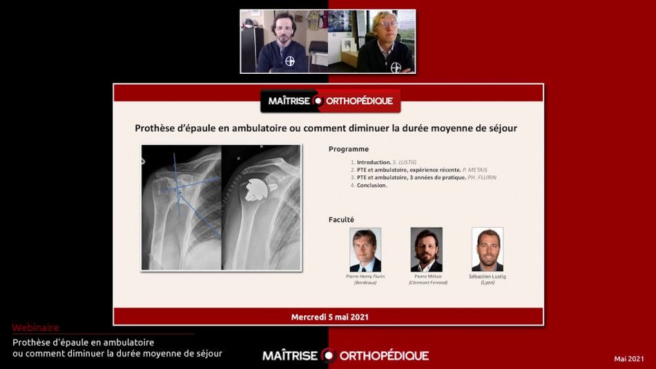 Prothèse d'épaule en ambulatoire, ou comment diminuer la durée moyenne de séjour.
