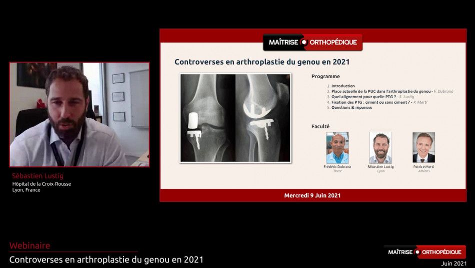 Controverses en arthroplastie du genou en 2021