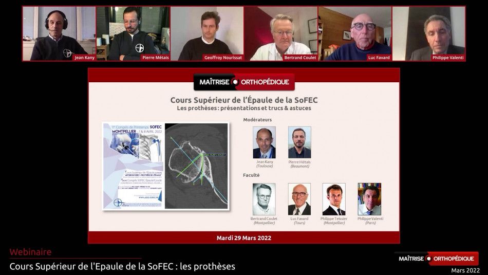Webinaire SoFEC - Les prothèses d'épaule : trucs et astuces
