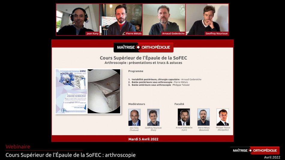 Webinaire SoFEC - Arthroscopie : trucs et astuces