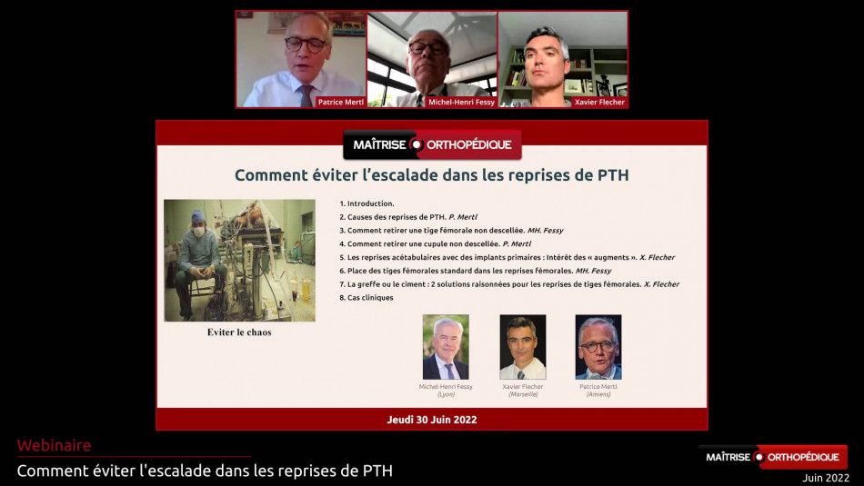 La "non escalade" en reprise de hanche