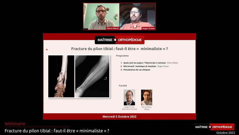 Fractures du pilon tibial : faut-il être "minimaliste" ?