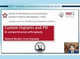 Prothèses et instrumentation sur mesure (Vidéo)