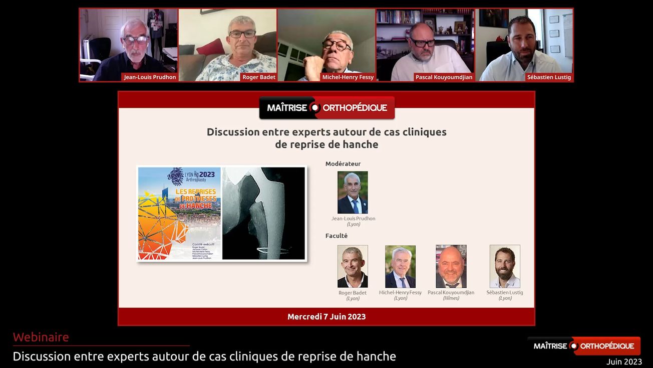 Discussion entre experts autour de cas cliniques de reprise de hanche