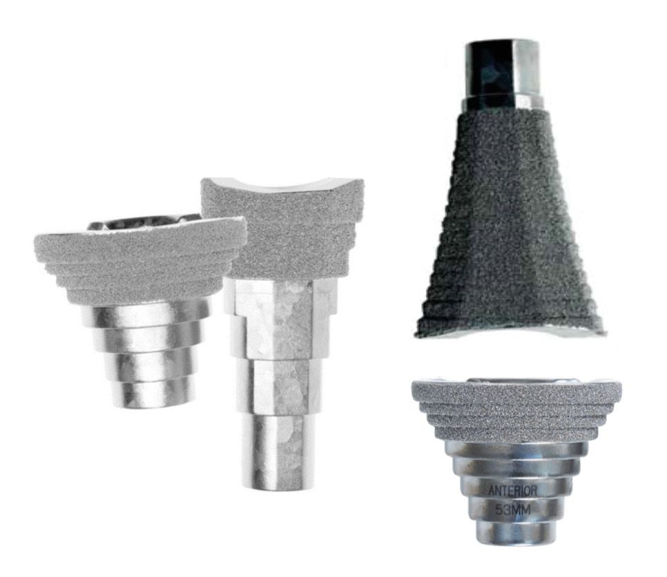 Intérêt des manchons et des cônes dans les reprises de PTG