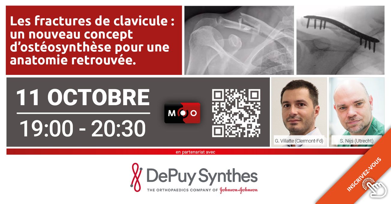 Les fractures de clavicule : un nouveau concept d’ostéosynthèse pour une anatomie retrouvée.