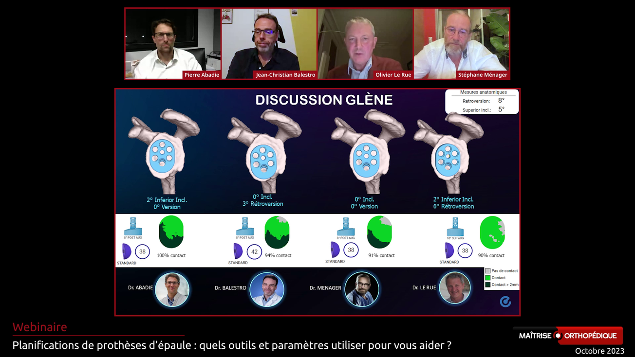 Planifications de prothèses d’épaule : quels outils et paramètres utiliser pour vous aider ?
