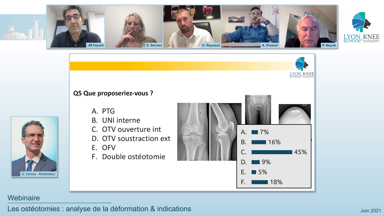 Les ostéotomies : analyse de la déformation & indications