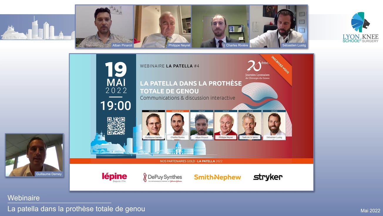 La patella #4 - La patella dans la prothèse totale de genou