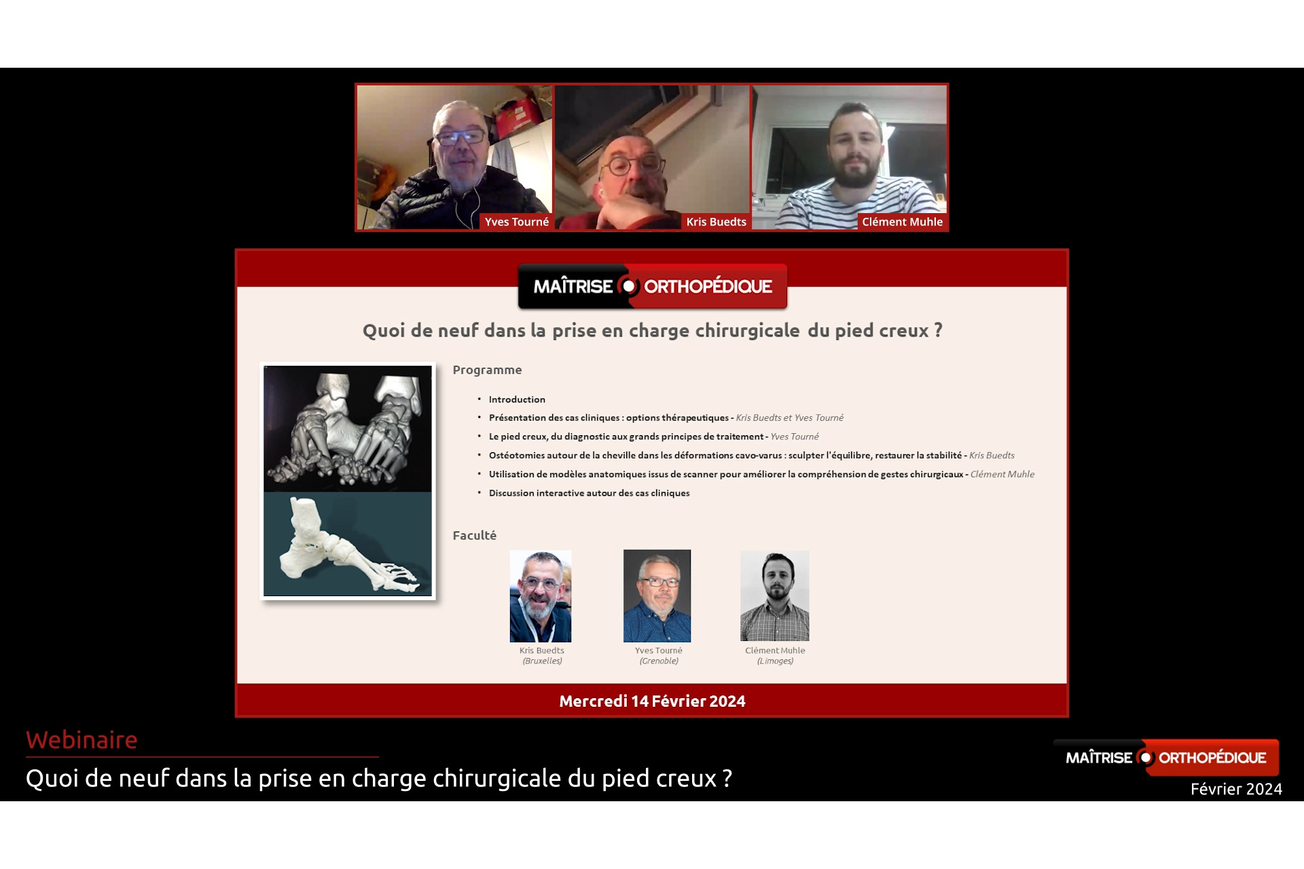 Quoi de neuf dans la prise en charge chirurgicale du pied creux ?