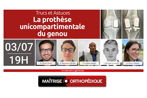 Trucs et Astuces : La prothèse unicompartimentale du genou
