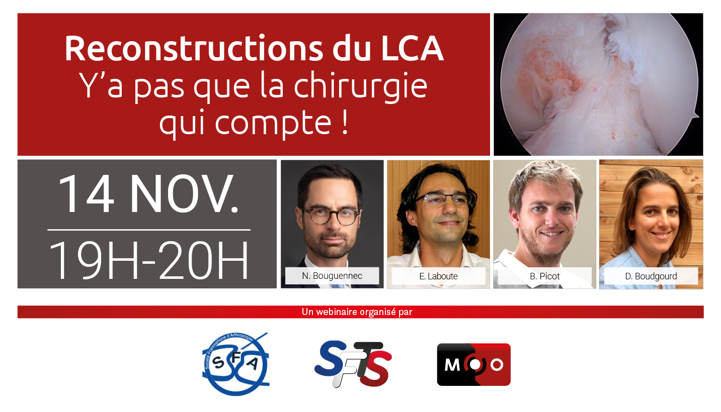 Reconstruction du LCA : Y'a pas que la chirurgie qui compte !