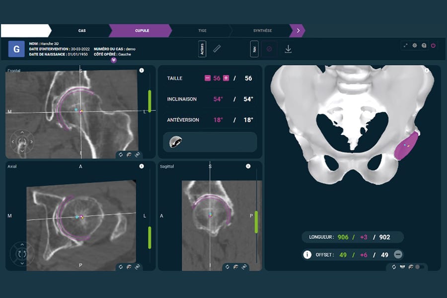 Orthopédie Française 2025 : analyse d'un secteur face à ses réalités économiques et technologiques