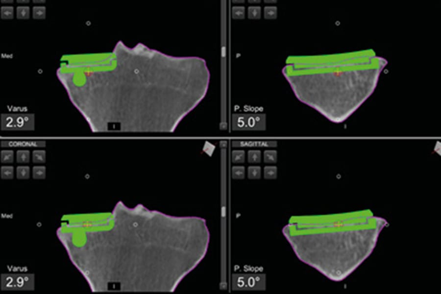 PUC, robot et reconstruction du LCA