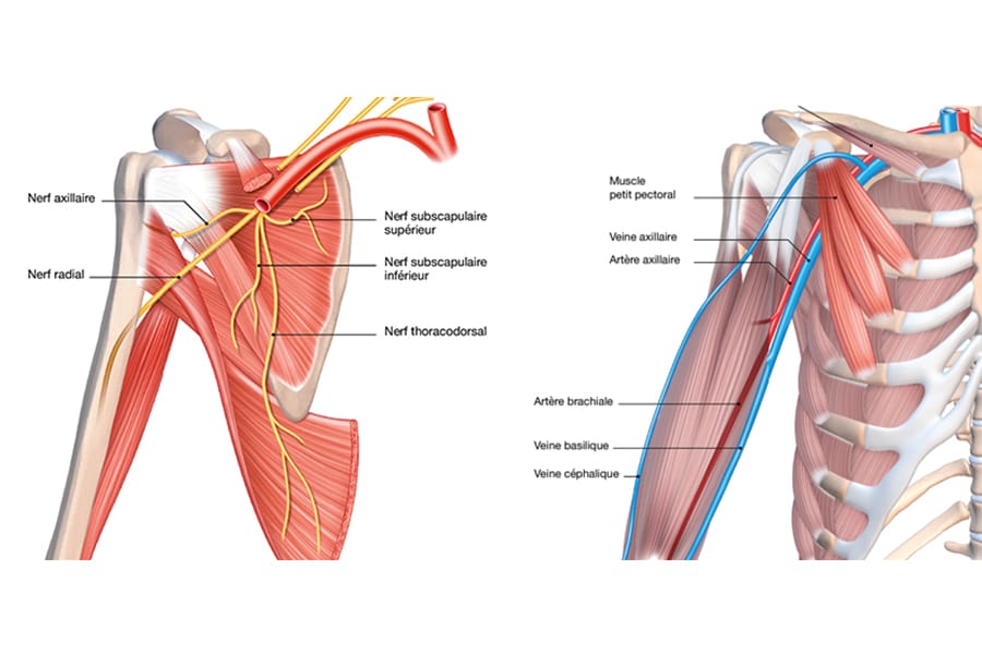 La douleur d’épaule en dedans de la coracoïde : penser à la rétraction du petit pectoral