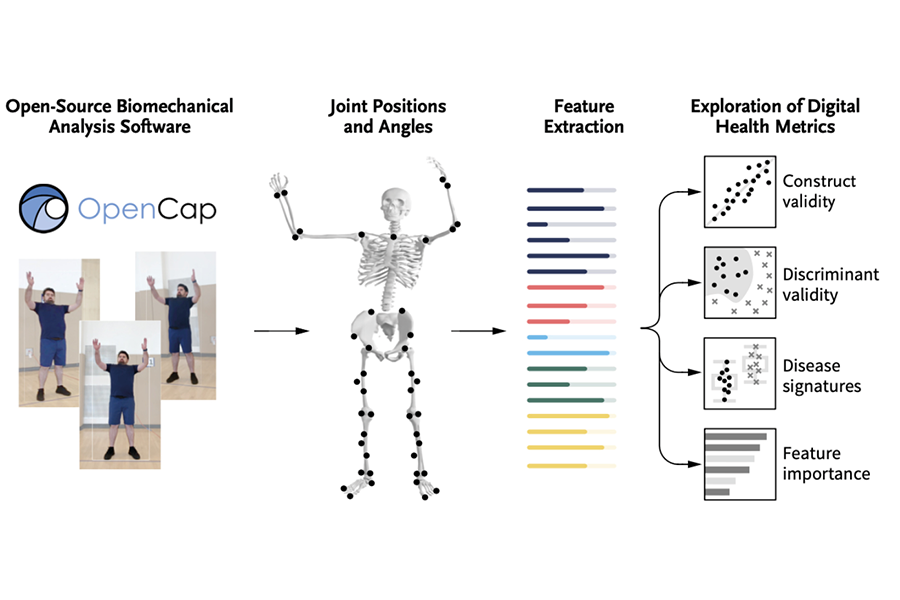 Qui et quand opérer ? Apport de l’IA